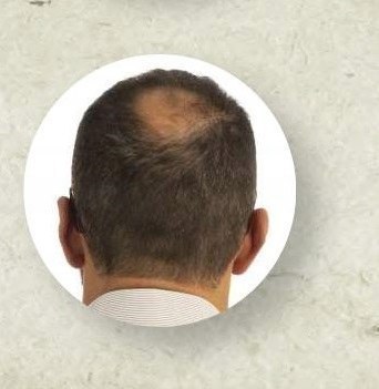 E661 BS GORDON dark blonde hair thickening fibres 22GR E661 BS GORDON dark blonde hair thickening fibres 22GR