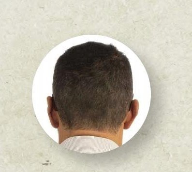 E661 N GORDON hair thickening fibres BLACK 22 GR E661 N GORDON hair thickening fibres BLACK 22 GR